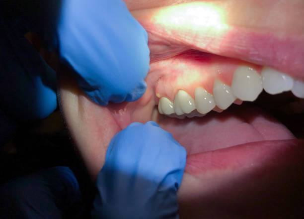  East Bronson, FL Emergency Dentist Pros