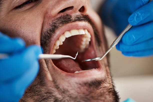 Best Weekend Emergency Dentist in East Bronson, FL
